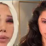 دیدم جران از عمل زیبایی تازه‌اش گفت؛ این بار «زیبایی کیم کارداشیان»
