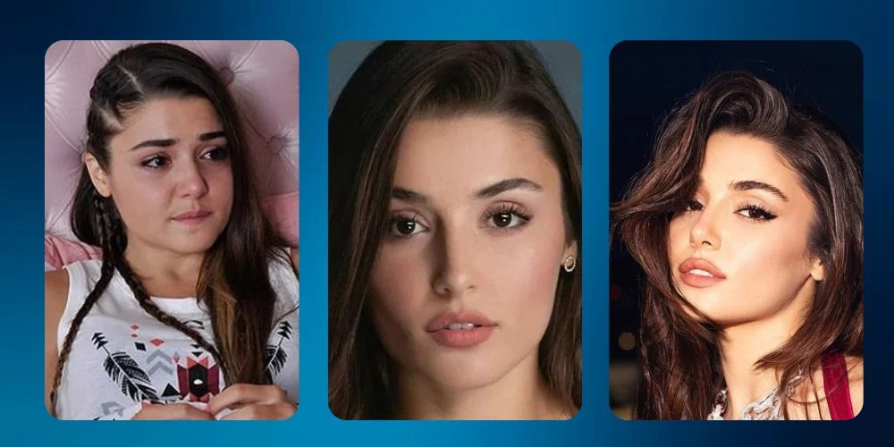 واکنش هانده ارچل به شایعات زیبایی؛ تکذیب بوتاکس، عکسهای قدیمی را دوباره داغ کرد