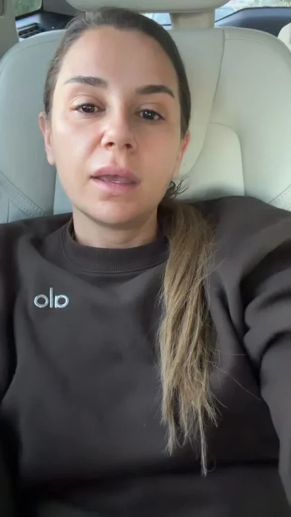 تلاش میکند به کنسرتهایش برسد. مروه اوزبِی (Merve Özbey) گفت با وجود حادثه ناگواری که برایش رخ داده، قصد دارد فعالیتهای صحنهایاش را متوقف نکند. او برای آنکه برنامههای از پیش تعیینشدهاش بههم نخورد، دوره درمانی فشردهای را پشت سر خواهد گذاشت.